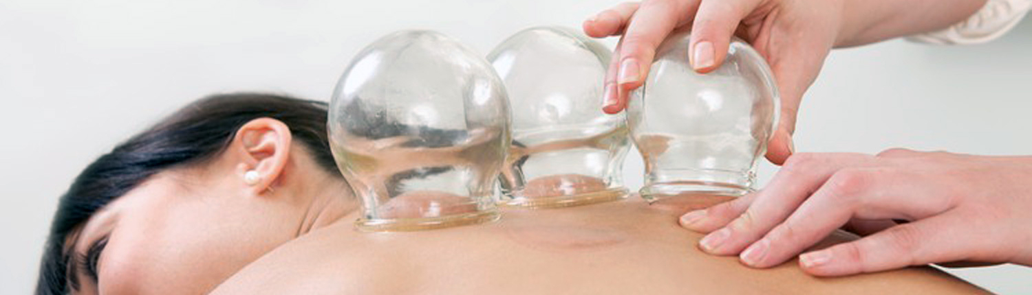 Traditional Chinese Cupping