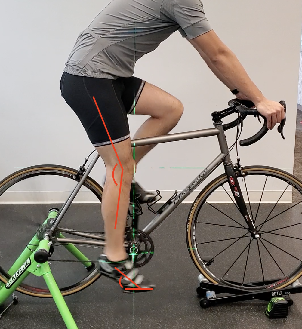Don’t Let Your Saddle Position Stop You From Achieving Your Cycling Goals