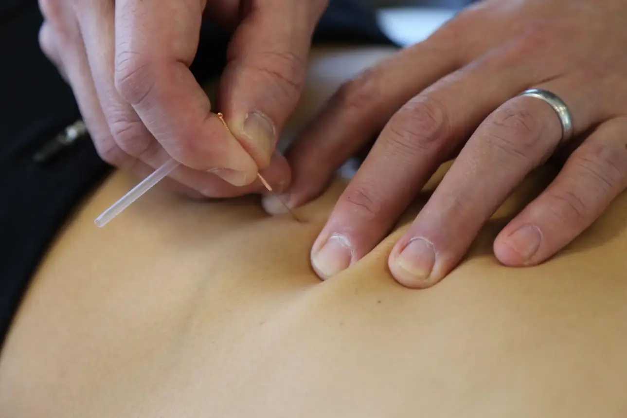 physiotherapy near me, physiotherapists kerrisdale